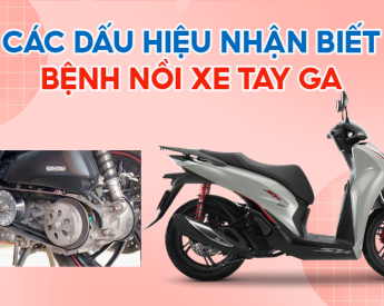 cac-dau-hieu-nhan-biet-benh-noi-xe-tay-ga